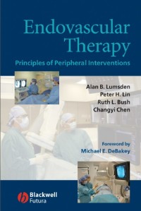 Endovascular Therapy: Principles of Peripheral Interventions