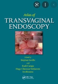 Atlas of Transvaginal Endoscopy